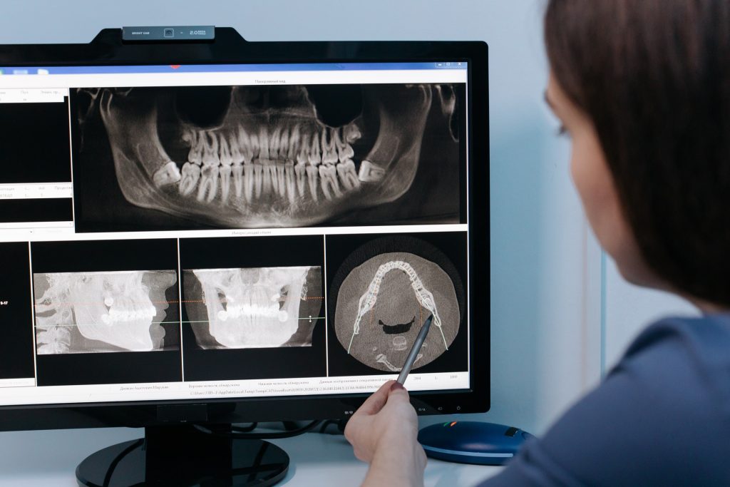 X-Rays & Digital Imaging