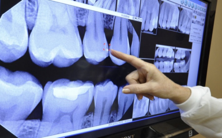 X-Rays & Digital Imaging