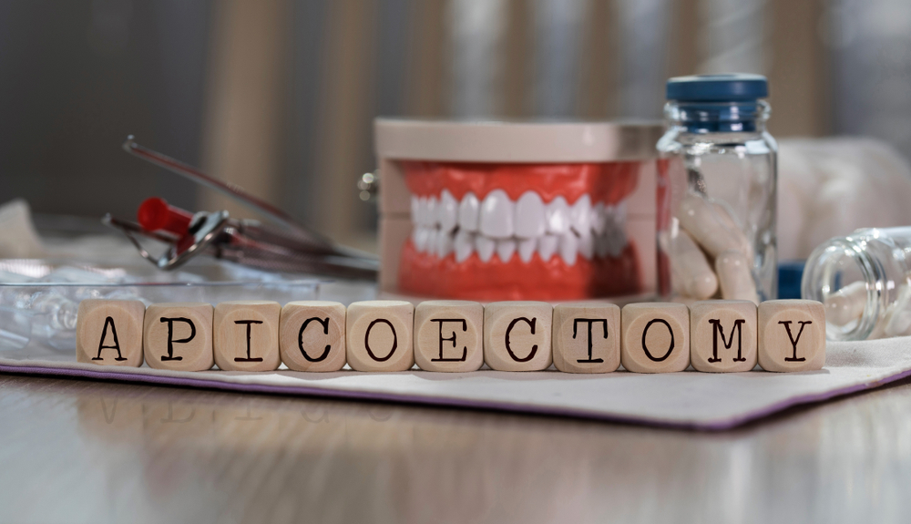 Apicoectomy