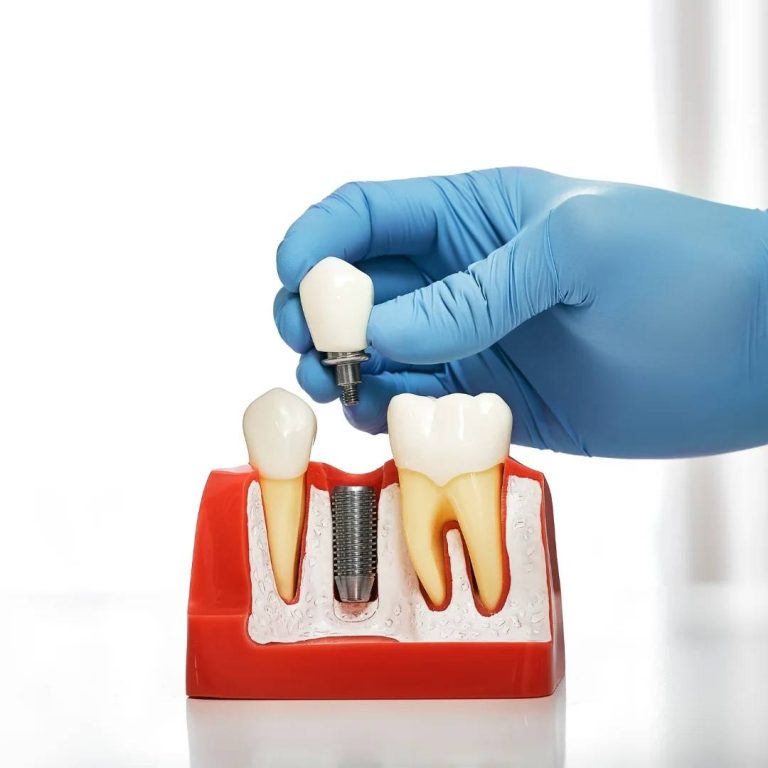 Implant Dentistry in Dorchester, ON