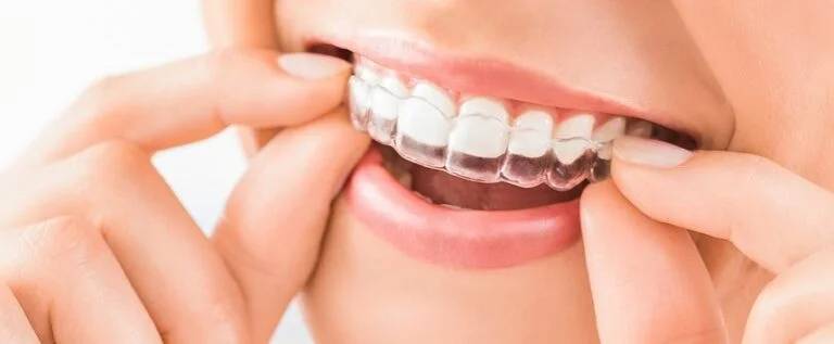 Invisalign in Dorchester, ON