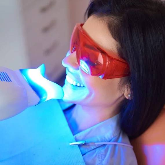 teeth whitening in Dorchester