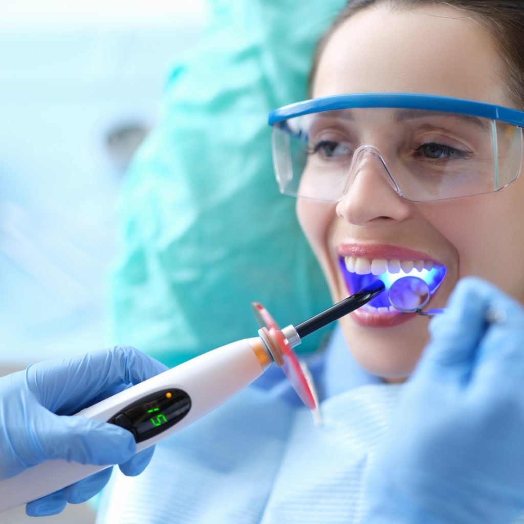 Dental Sealants