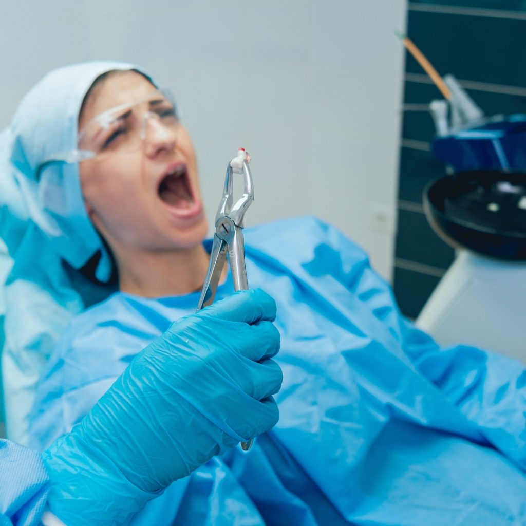 Tooth Extractions