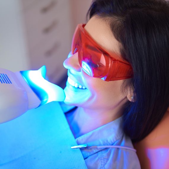 Teeth Whitening